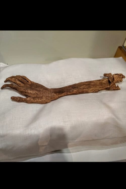The Arm of Antietam